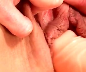 Labios vaginales